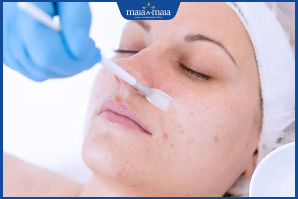 Peel da bao nhiêu tiền? Cảnh báo trào lưu làm đẹp da giá rẻ và nguy hiểm tiềm ẩn  2 thực hiện peel da