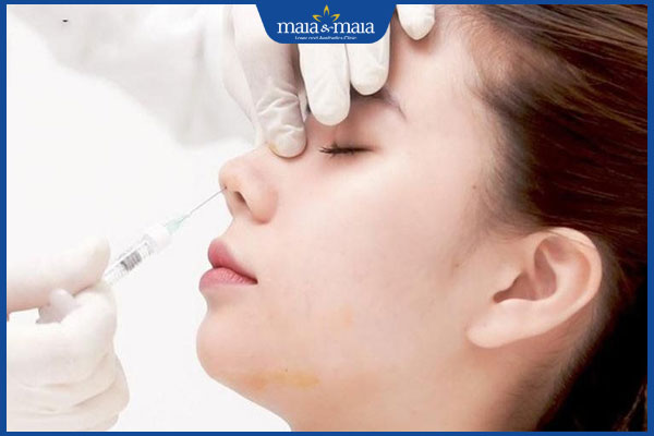 Tiêm filler bao lâu thì tan? Lưu ý để duy trì hiệu quả lâu dài 2 thực hiện tiêm filler mũi