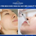 tiêm bap và tiêm meso