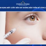 tiêm bọng mắt cười