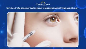 Thế nào là tiêm bọng mắt cười? Nên hay không nên thẩm mỹ vùng da dưới mắt? 76 tiêm bọng mắt cười