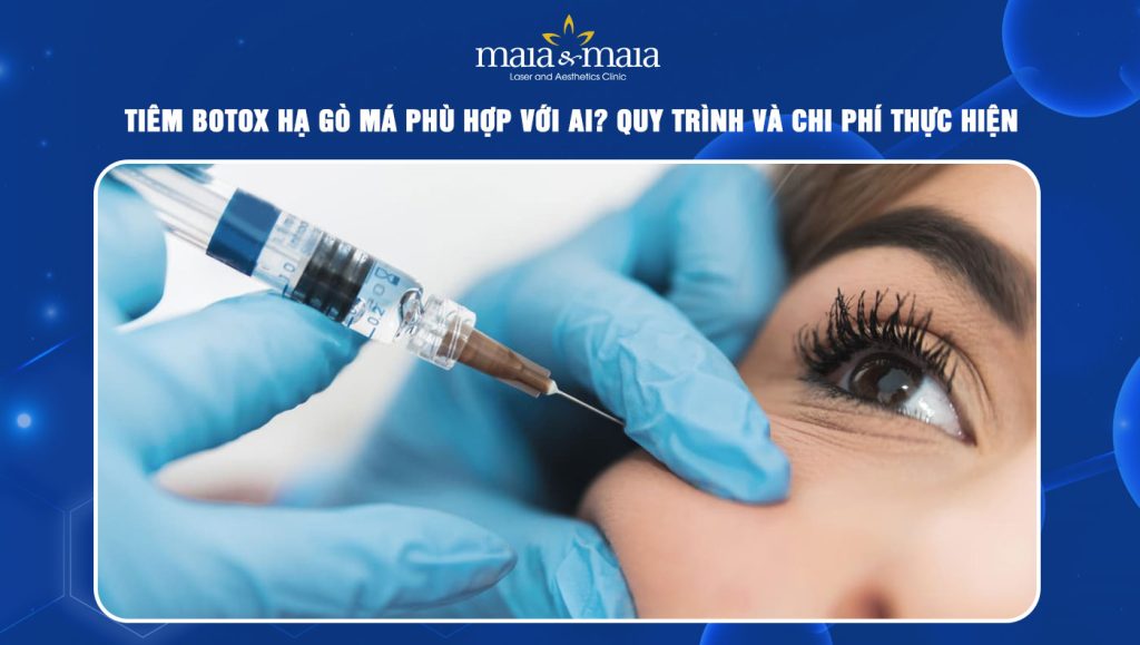 Tiêm botox hạ gò má