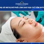 tiêm botox hạ gò má bị đơ