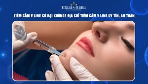 Tiêm cằm V line có hại không? Địa chỉ tiêm cằm V line uy tín, an toàn  108 tiêm cằm V line có hại không