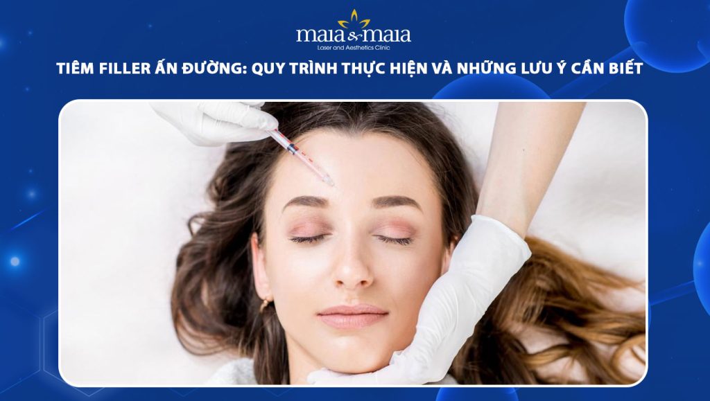 tiêm filler ấn đường