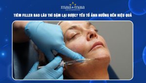 Tiêm filler bao lâu thì dặm lại được? Yếu tố ảnh hưởng đến hiệu quả filler 102 tiêm filler bao lâu thì dặm lại được