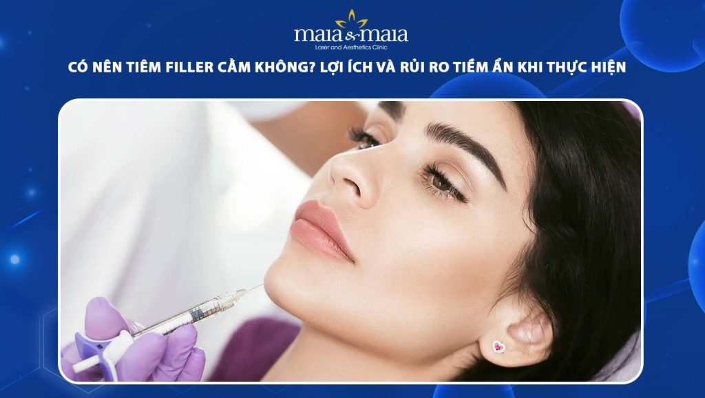 tiêm filler cằm