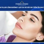 tiêm filler cằm
