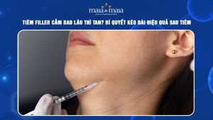 Tiêm filler cằm bao lâu thì tan? Bí quyết kéo dài hiệu quả sau tiêm 59 tiêm filler cằm bao lâu thì tan