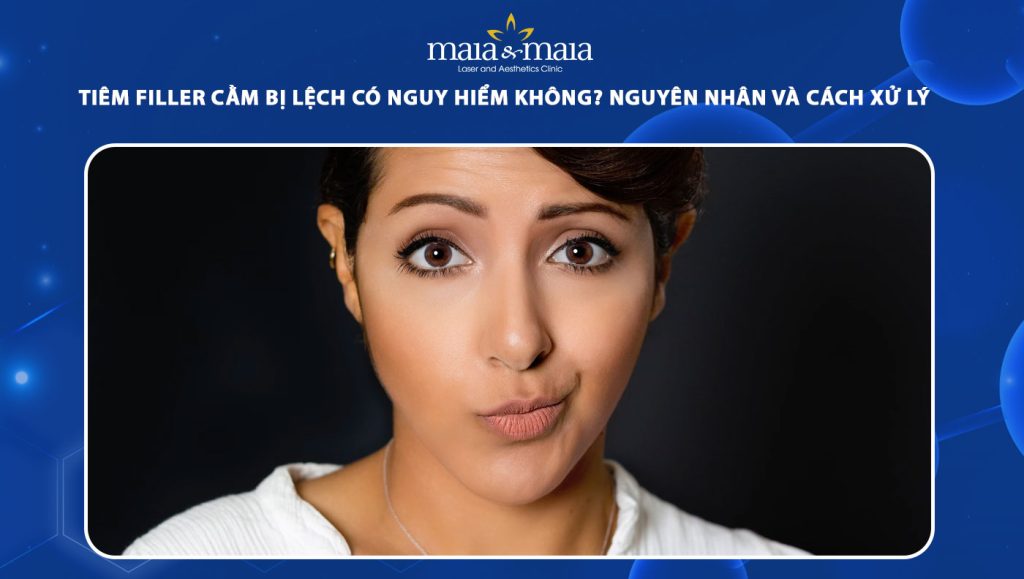 tiêm filler cằm bị lệch