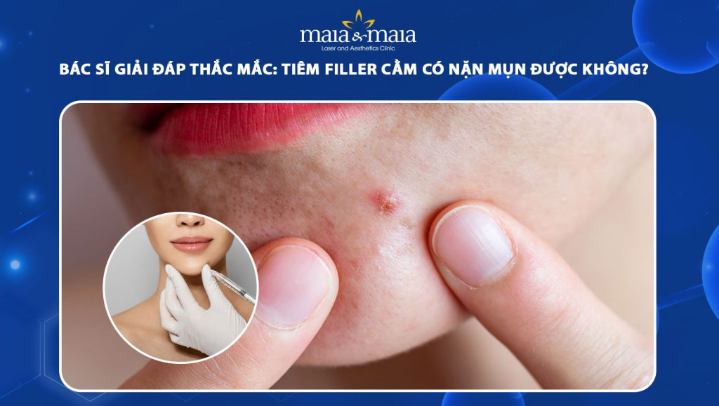 tiêm filler cằm có nặn mụn được không