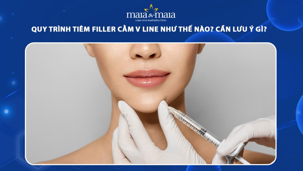 tiêm filler cằm vline