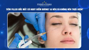 Tiêm filler hốc mắt có nguy hiểm không? Ai nên và không nên thực hiện? 57 Tiêm filler hốc mắt