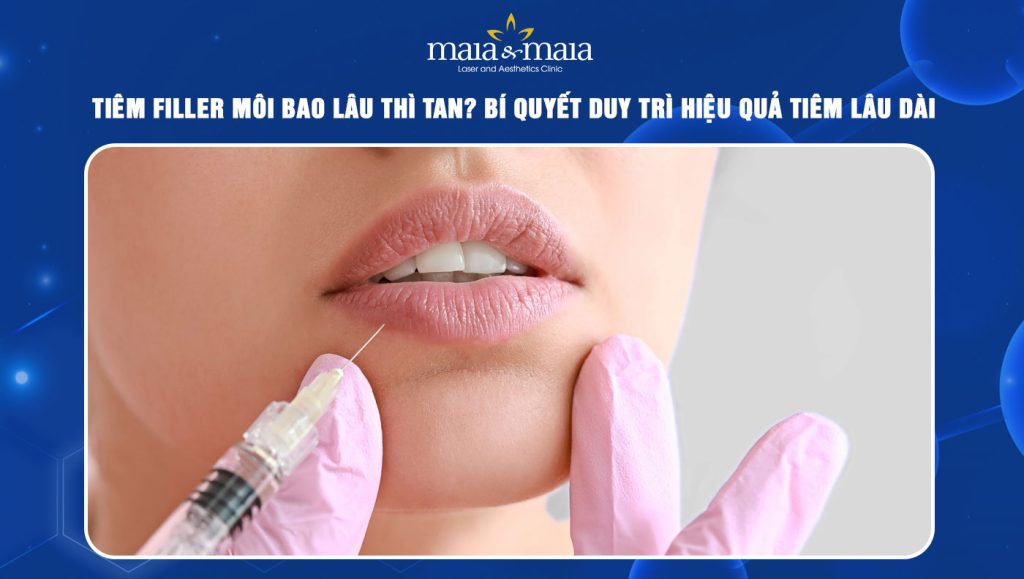 tiêm filler môi bao lâu thì tan