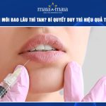 tiêm filler môi bao lâu thì tan