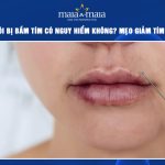 Tiêm filler môi bị bầm tím