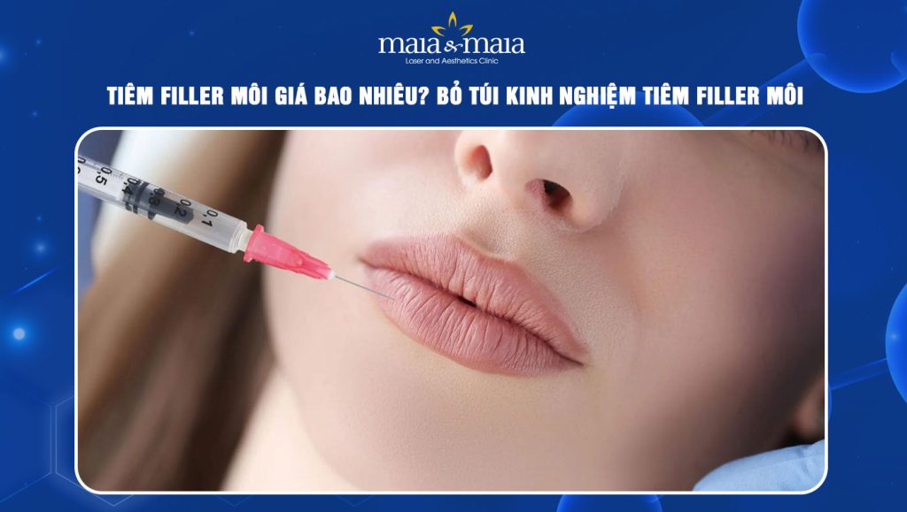 tiêm filler môi giá bao nhiêu