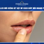 tiêm filler môi kiêng gì