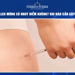Tiêm filler mông có nguy hiểm không