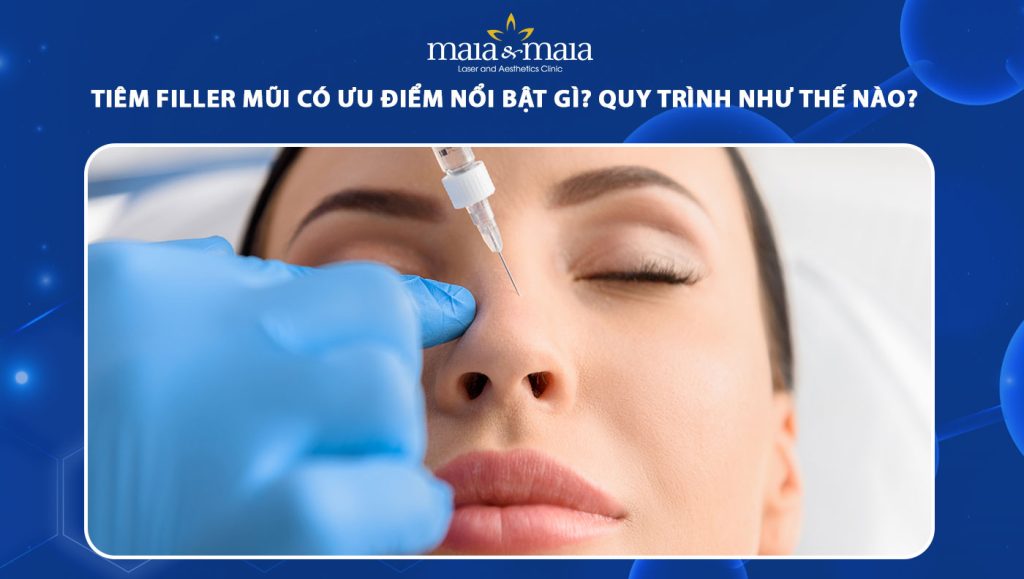 tiêm filler mũi