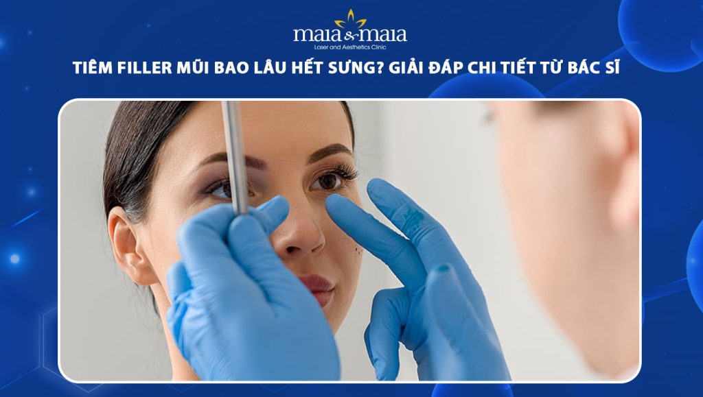 tiêm filler mũi bao lâu hết sưng