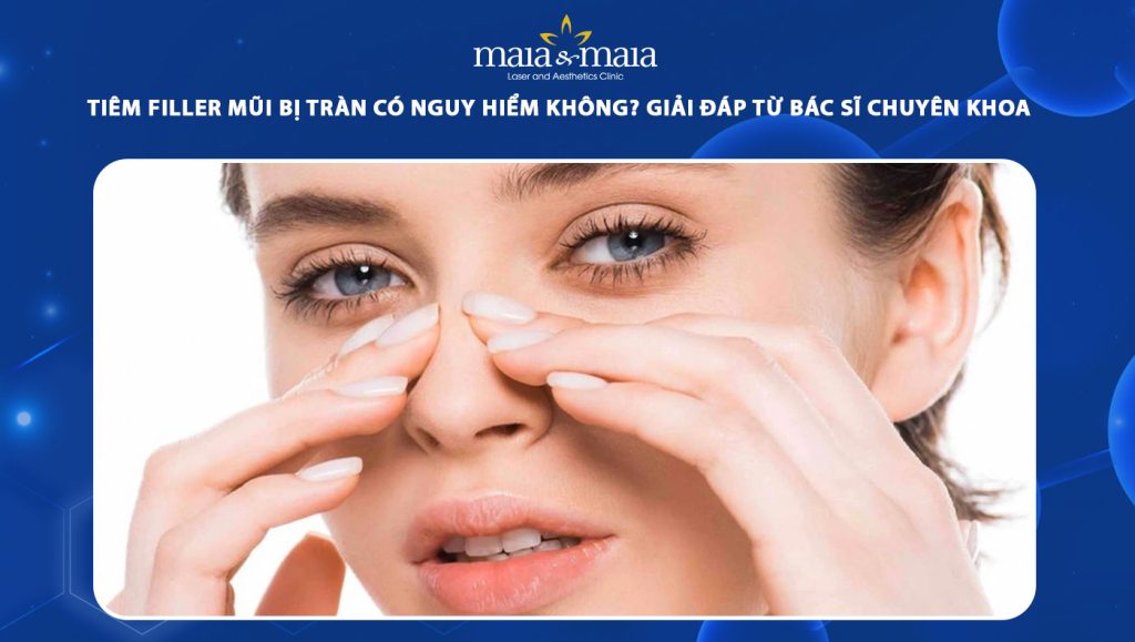 tiêm filler mũi bị tràn
