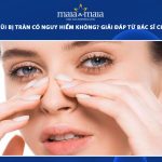 tiêm filler mũi bị tràn