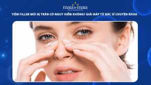 Tiêm filler mũi bị tràn có nguy hiểm không? Giải đáp từ bác sĩ chuyên khoa 58 tiêm filler mũi bị tràn