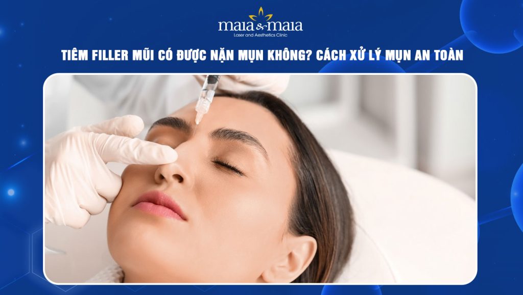 tiêm filler mũi có được nặn mụn không