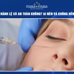 tiêm filler rãnh lệ