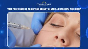 Tiêm filler rãnh lệ có an toàn không? Ai nên và không nên thực hiện? 90 tiêm filler rãnh lệ
