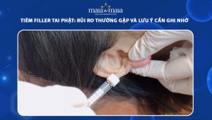 Tiêm filler tai phật: Rủi ro thường gặp và lưu ý cần ghi nhớ 66 tiêm filler tai phật