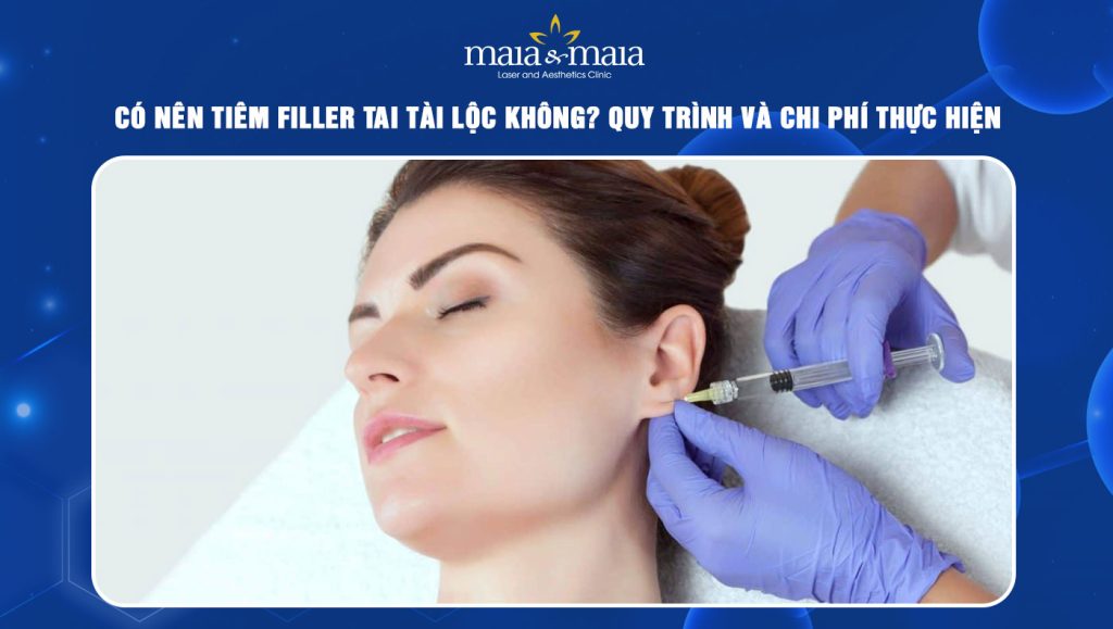 Tiêm filler tai tài lộc