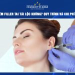 Tiêm filler tai tài lộc