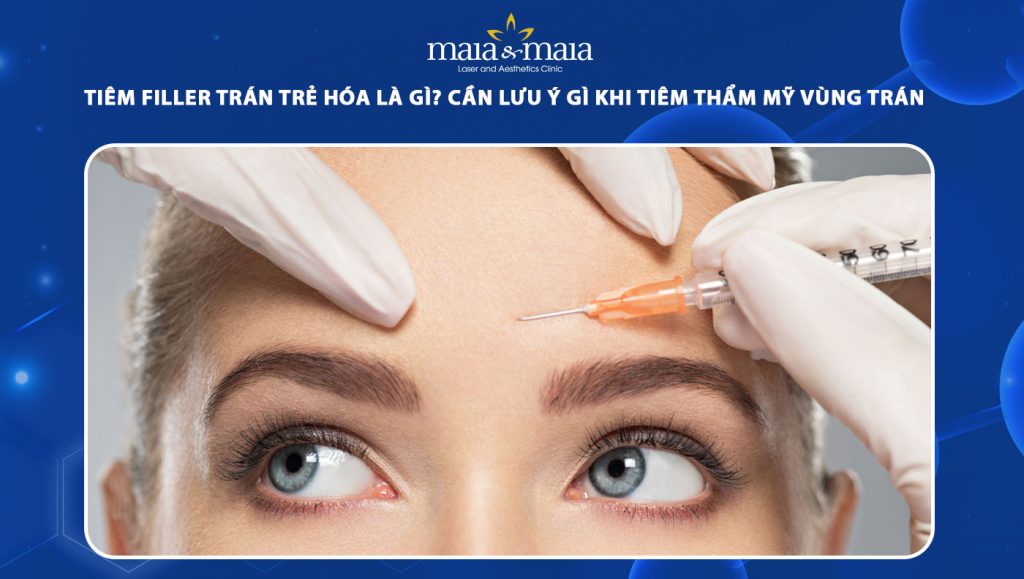 tiêm filler trán