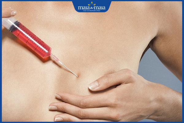 Tiêm filler ngực có an toàn không? Cảnh báo biến chứng nguy hiểm 2 tiêm filler vào ngực