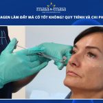 tiêm HA collagen làm đầy má