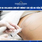 Tiêm HA collagen làm đầy mông