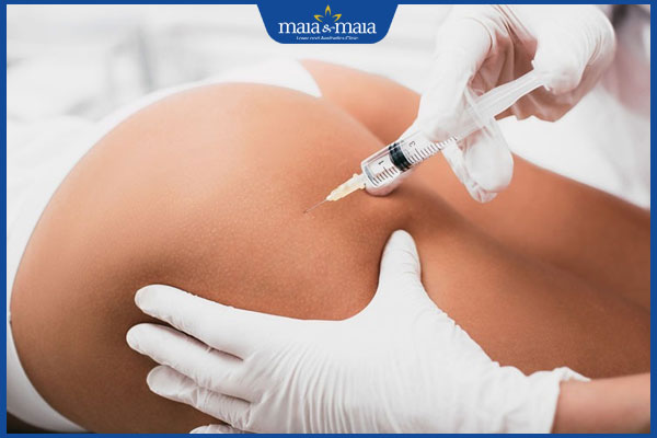 Có nên tiêm HA collagen làm đầy mông? Các rủi ro tiềm ẩn cần lưu ý  2 tiêm ha vào mông