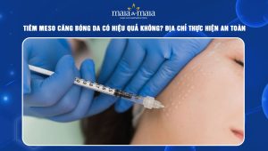 Tiêm meso căng bóng da có hiệu quả không? Địa chỉ thực hiện an toàn 49 Tiêm meso căng bóng da