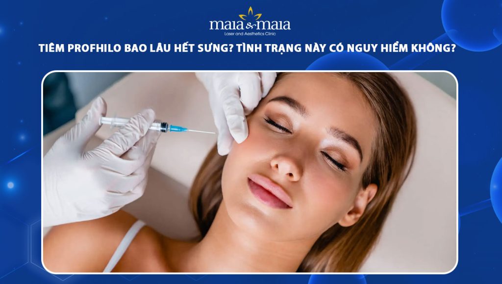 tiêm profhilo bao lâu hết sưng