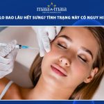 tiêm profhilo bao lâu hết sưng