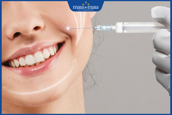 Tiêm filler rãnh cười có hại không? Những biến chứng tiềm ẩn cần đặc biệt lưu ý 3 tiêm xóa rãnh cười