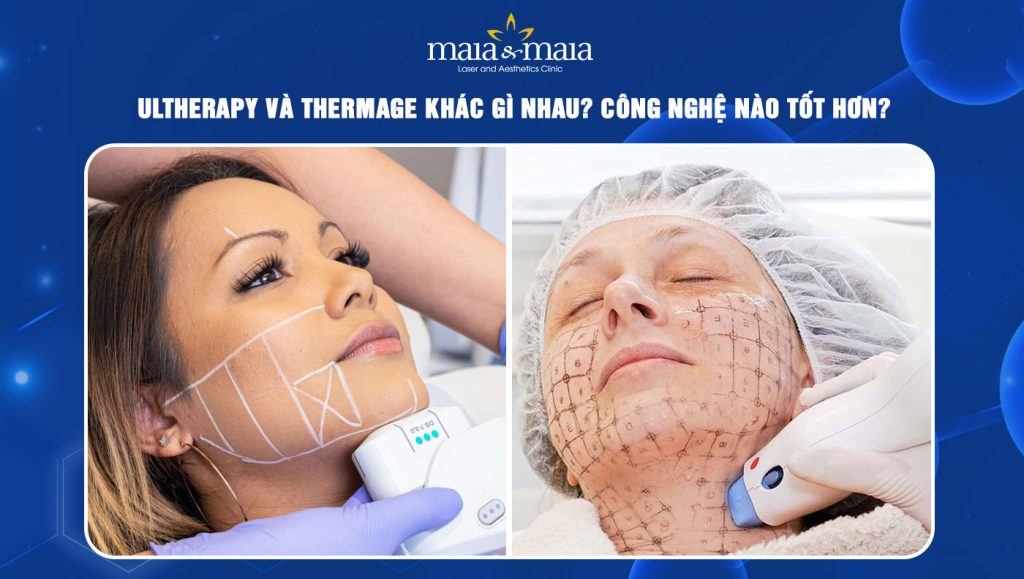 Ultherapy và Thermage