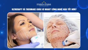 Ultherapy và Thermage khác gì nhau? Công nghệ nào tốt hơn? 43 Ultherapy và Thermage