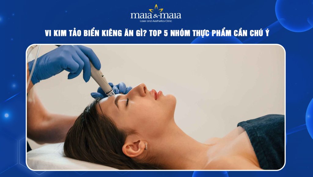vi kim tảo biển kiêng ăn gì