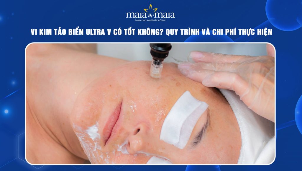 Vi kim tảo biển Ultra V