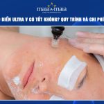 Vi kim tảo biển Ultra V