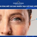 xóa nhăn vùng mặt giá bao nhiêu