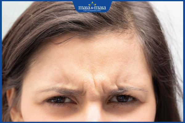 Nếp nhăn giữa 2 chân mày xóa bỏ được không? Cách cải thiện và phòng ngừa hiệu quả cao 2 xuất hiện nếp nhăn ở 2 chân mày